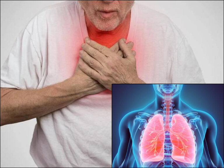 lungenembolie wie schnell stirbt man